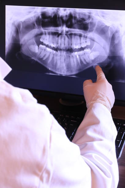 Best Emergency Root Canal Treatment in Quitman, GA